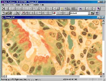 Microscopy Tissue Image